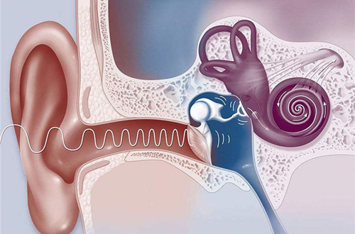 1733296584439576.jpg 人工耳蝸.jpg