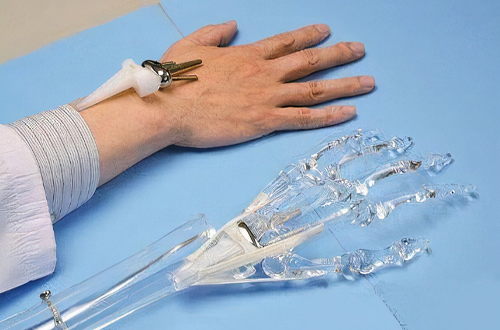 1733296601794254.jpg 人工關(guān)節(jié) 1.jpg